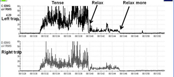 Figure 1 Muscle tension