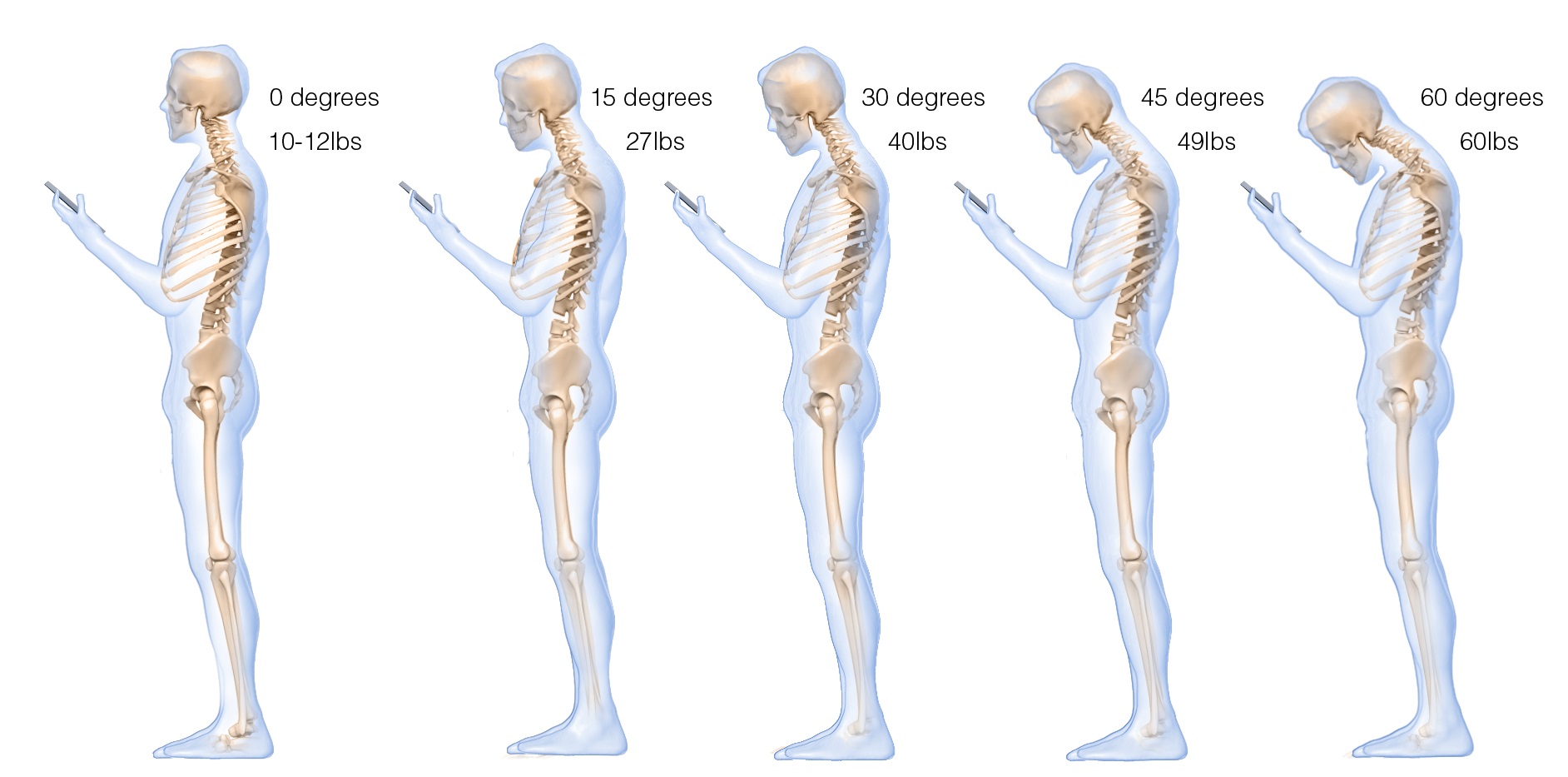 Figure 2 head collapse